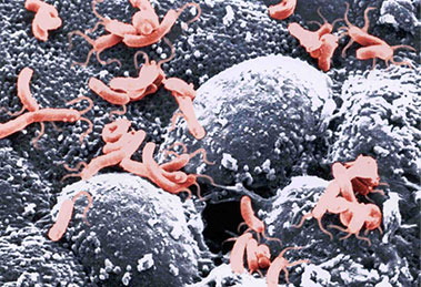 Helicobacter-pylori-bacteria_image